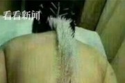 中医恶搞视频，中医恶搞视频下载